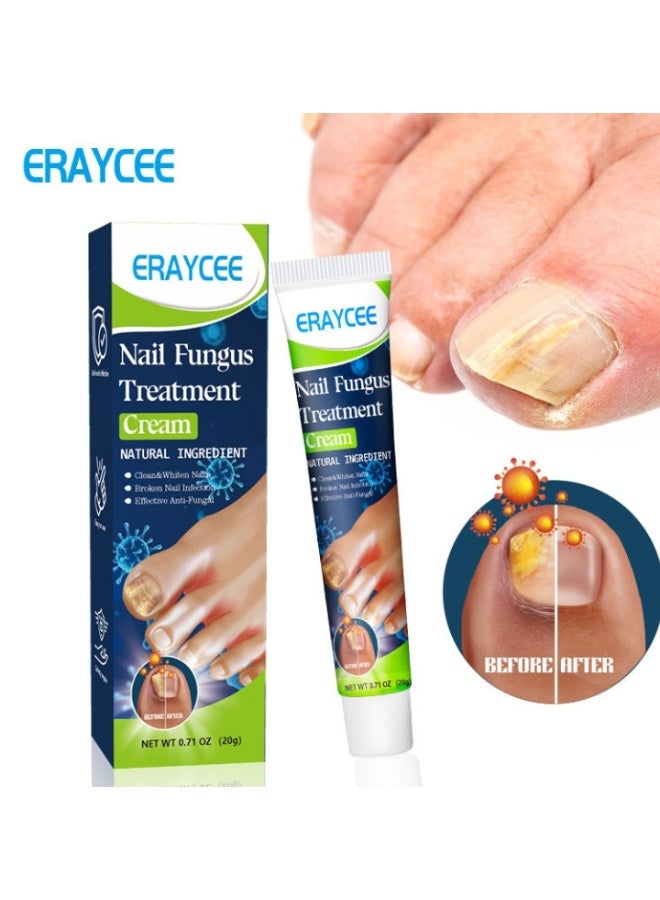 ERAYCEE Nail Fungus Treatment Cream, 20g Toenail Fungus Treatment Cream - Image 1